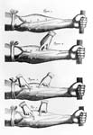 Harvey vein valves