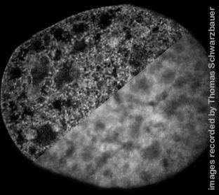 comparison STED and confocal